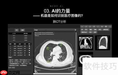 智能医疗影像系统方案开发:推动医疗行业新变革