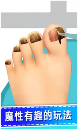 老板修个脚甲沟炎