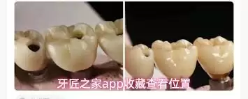 牙匠之家app如何查看收藏-牙匠之家app怎样查看收藏