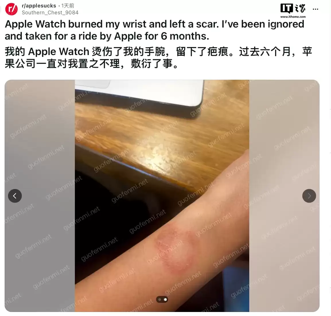 Apple Watch Ultra 2屏幕失灵强制重启与排障全攻略